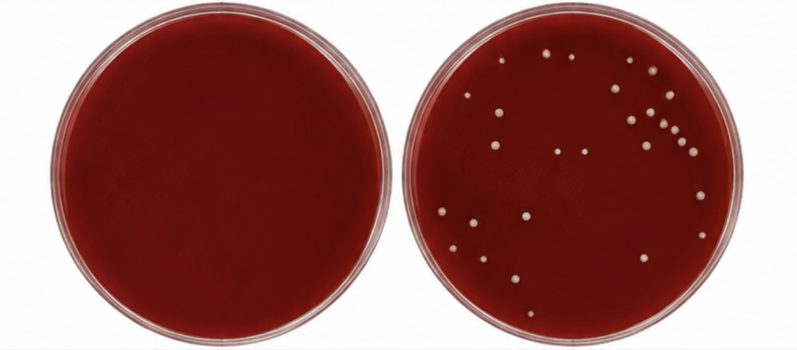 P. Levii colony growth on non-PRAS/PRAS media